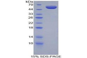 SDS-PAGE (SDS) image for Brother Of CDO (BOC) (AA 668-866) protein (His tag) (ABIN2122516) (BOC Protein (AA 668-866) (His tag))