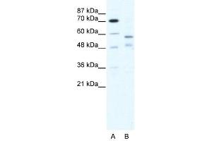 TRIM23 antibody (20R-1190) used at 0. (TRIM23 Antikörper  (C-Term))