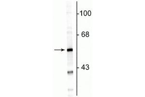 Western blot of rat cortical lysate showing specific immunolabeling of the ~50 kDa GFAP protein. (GFAP Antikörper)