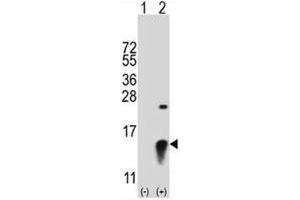 Western blot analysis of SUMO2 antibody and 293 cell lysate (2 ug/lane) either nontransfected (Lane 1) or transiently transfected (2) with the SUMO2 gene. (SUMO2 Antikörper  (AA 63-93))
