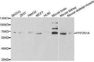 Western blot analysis of extracts of various cell lines, using PPP2R1A antibody. (PPP2R1A Antikörper)