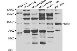 Western blot analysis of extracts of various cell lines, using IWS1 antibody. (IWS1 Antikörper)