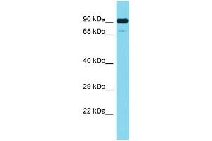 Host: Rabbit Target Name: CEP89 Sample Type: Jurkat Whole Cell lysates Antibody Dilution: 1. (CEP89 Antikörper  (N-Term))