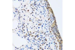 Immunohistochemistry of paraffin-embedded rat lung using MTA3 antibody (ABIN5974011) at dilution of 1/100 (40x lens). (MTA3 Antikörper)
