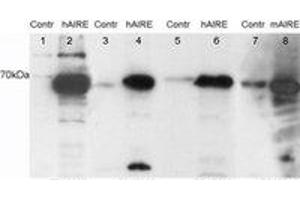 Image no. 1 for anti-Autoimmune Regulator (AIRE) (C-Term) antibody (ABIN374235) (AIRE Antikörper  (C-Term))