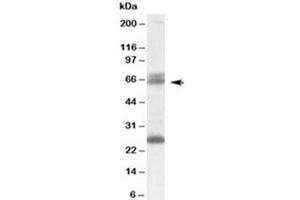 Western blot testing of human brain lysate with GAD65 antibody at 0. (GAD65 Antikörper)