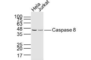 Lane 1: hela lysates Lane 2: jurkat lysates probed with Caspase 8 Monoclonal Polyclonal Antibody, Unconjugated  at 1:300 dilution and 4˚C overnight incubation. (Caspase 8 Antikörper)