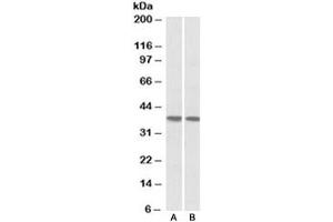 Western blot testing of human heart [A] and lung [B] lysates with KLF2 antibody at 1ug/ml. (KLF2 Antikörper)