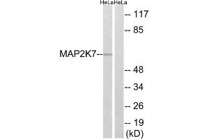 Western Blotting (WB) image for anti-Mitogen-Activated Protein Kinase Kinase 7 (MAP2K7) (Ser271) antibody (ABIN1848234) (MAP2K7 Antikörper  (Ser271))