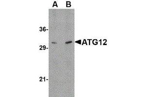 Western Blotting (WB) image for anti-Autophagy Related 12 (ATG12) (N-Term) antibody (ABIN2477525) (ATG12 Antikörper  (N-Term))