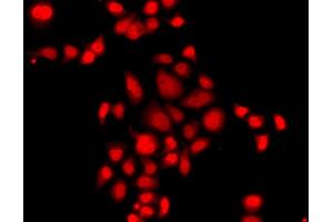 Immunofluorescence analysis of A549 cells using MLF1 antibody (ABIN5974950). (MLF1 Antikörper)