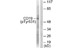 Western blot analysis of extracts from COS7 cells, treated with Serum (10%, 30mins), using CD19 (Phospho-Tyr531) Antibody. (CD19 Antikörper  (pTyr531))