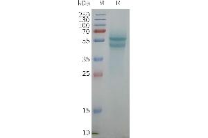 SDS-PAGE (SDS) image for Adrenergic, beta-1-, Receptor (ADRB1) protein (ABIN7538126)