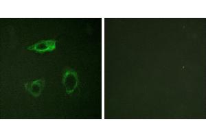 P-peptide - +Western blot analysis of extracts from COS cells, treated with EGF (200ng/ml, 30mins), using CD18/ITGB2 (Phospho-Thr758) antibody. (Integrin beta 2 Antikörper  (pThr758))