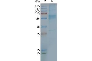 Human GIPR-Nanodisc, Flag Tag on SDS-PAGE (GIPR Protein)