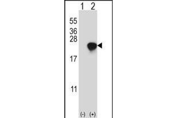 ARL2 Antikörper  (C-Term)