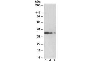 Western blot testing of human liver lysate [lane 1], mouse liver [lane 2] and rat liver [lane 3] with PP2A antibody at 0. (PPP2R4 Antikörper)
