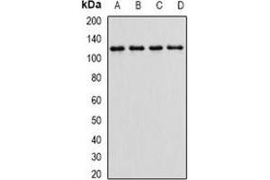 Western blot analysis of Alpha E-catenin expression in HEK293T (A), MCF7 (B), mouse kidney (C), mouse brain (D) whole cell lysates. (CTNNA1 Antikörper)