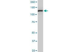 CAND1 monoclonal antibody (M03), clone 2D7. (CAND1 Antikörper  (AA 1-100))