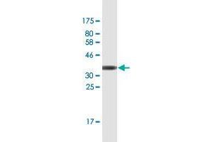 Western Blot detection against Immunogen (36. (FBXO11 Antikörper  (AA 744-843))