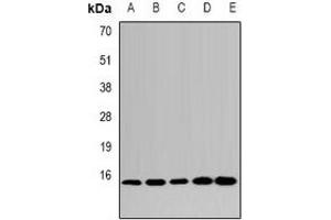Western blot analysis of LSm4 expression in HepG2 (A), MCF7 (B), mouse kidney (C), mouse heart (D), rat liver (E) whole cell lysates. (LSM4 Antikörper)