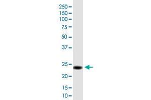 MGC50273 monoclonal antibody (M01), clone 3B10. (MGC50273 (AA 1-209) Antikörper)