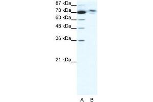 Human HepG2; WB Suggested Anti-C14ORF101 Antibody Titration: 0. (C14orf101 Antikörper  (N-Term))