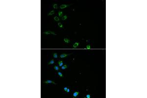 Immunofluorescence analysis of MCF7 cell using HFE antibody. (HFE Antikörper)