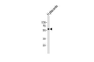 Western blot analysis of lysate from human placenta tissue lysate, using FOXO4 Antibody (C-term) (ABIN6242148 and ABIN6577869). (FOXO4 Antikörper  (C-Term))