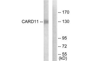 Western Blotting (WB) image for anti-Caspase Recruitment Domain Family, Member 11 (CARD11) (N-Term) antibody (ABIN1850240) (CARD11 Antikörper  (N-Term))