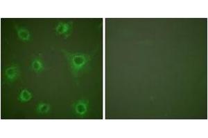 Immunofluorescence analysis of COS7 cells, using Collagen II Antibody. (COL2 Antikörper  (AA 101-150))