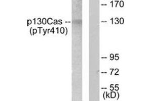 Western blot analysis of extracts from NIH-3T3 cells, using p130 Cas (Phospho-Tyr410) Antibody. (BCAR1 Antikörper  (pTyr410))