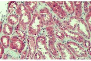 Human Kidney: Formalin-Fixed, Paraffin-Embedded (FFPE) (Claudin 2 Antikörper  (AA 135-164))