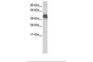 Image no. 1 for anti-Zinc Finger and BTB Domain Containing 43 (ZBTB43) (AA 188-237) antibody (ABIN6736063) (ZBTB43 Antikörper  (AA 188-237))