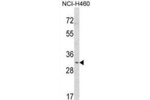 Western Blotting (WB) image for anti-SNAI antibody (ABIN2912021) (SNAI Antikörper)