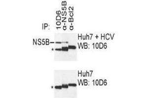 Western Blotting (WB) image for anti-Hepatitis C Virus NS5 (HCV NS5) (AA 111-130) antibody (ABIN781785) (HCV NS5 Antikörper  (AA 111-130))