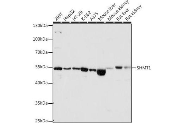 SHMT1 Antikörper  (AA 285-444)