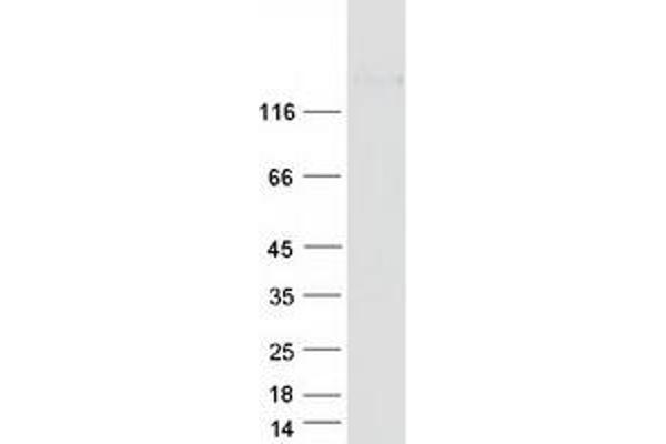 CACNA2D2 Protein (Transcript Variant 3) (Myc-DYKDDDDK Tag)