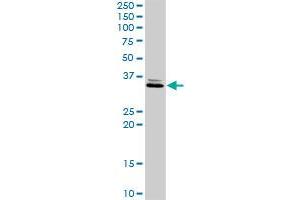 RDHE2 MaxPab rabbit polyclonal antibody. (SDR16C5 Antikörper  (AA 1-309))