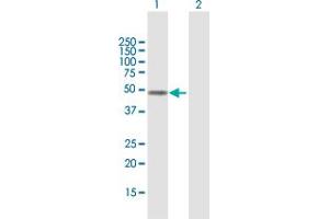 Western Blot analysis of FOXD4L1 expression in transfected 293T cell line by FOXD4L1 MaxPab polyclonal antibody. (FOXD4L1 Antikörper  (AA 1-408))