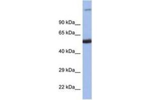 Image no. 1 for anti-Interferon Regulatory Factor 8 (IRF8) (C-Term) antibody (ABIN6747508) (IRF8 Antikörper  (C-Term))