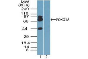 Image no. 1 for anti-Forkhead Box O1 (FOXO1) (AA 250-300) antibody (ABIN960178) (FOXO1 Antikörper  (AA 250-300))