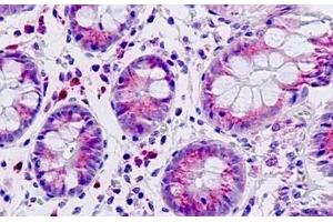 Human Intestine: Formalin-Fixed, Paraffin-Embedded (FFPE) (DAB1 Antikörper  (AA 199-248))