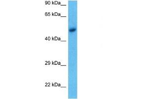 WB Suggested Anti-ACHA9 antibody Titration: 1 ug/mL Sample Type: Human MCF7 Whole Cell (CHRNA9 Antikörper  (N-Term))
