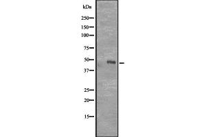Western blot analysis of CD177 expression in Transfected 293T cell lysate,The lane on the left is treated with the antigen-specific peptide. (CD177 Antikörper  (Internal Region))