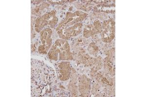 Immunohistochemical analysis of (ABIN392043 and ABIN2841811) on paraffin-embedded Human kidney tissue. (ROR1 Antikörper)