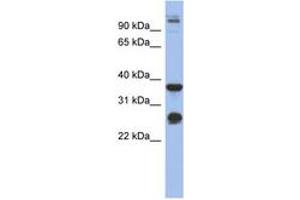 Image no. 1 for anti-Biglycan (BGN) (AA 215-264) antibody (ABIN6744047) (Biglycan Antikörper  (AA 215-264))