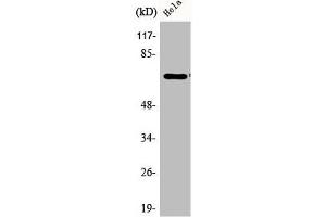 Western Blot analysis of HeLa cells using Phospho-Paxillin (Y31) Polyclonal Antibody (Paxillin Antikörper  (pTyr31))