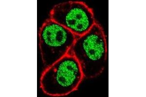 Immunofluorescence (IF) image for anti-Parafibromin (CDC73) antibody (ABIN3004068) (HRPT2 Antikörper)