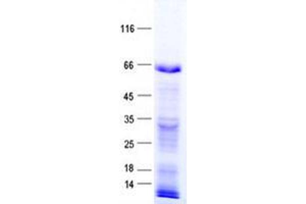 ZNF37A Protein (His tag)